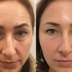 Ceoerty™ EyeGlo Bee Venom Collagen Eye Cream