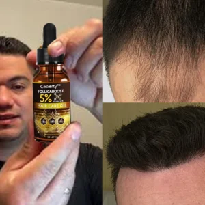 Ceoerty™ FollicaBoost 5% Minoxidil Hair Care Oil