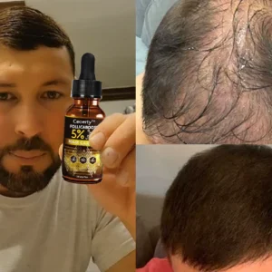 Ceoerty™ FollicaBoost 5% Minoxidil Hair Care Oil