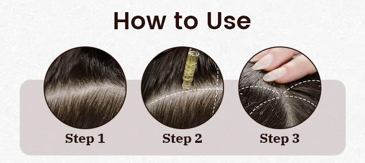 Ceoerty™ FollicaBoost 5% Minoxidil Hair Care Oil