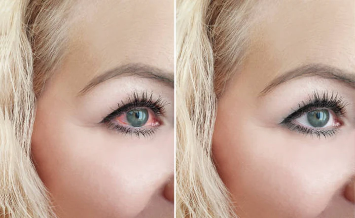 EyeRelief Therapeutic Cleansing Wipes