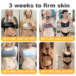 FDA Approved-𝐅𝐥𝐲𝐬𝐦𝐮𝐬™ 𝐀𝐝𝐯𝐚𝐧𝐜𝐞𝐝 𝐂𝐨𝐥𝐥𝐚𝐠𝐞𝐧 𝐏𝐞𝐩𝐭𝐢𝐝𝐞 𝐅𝐢𝐫𝐦𝐢𝐧𝐠 𝐂𝐫𝐞𝐚𝐦, 𝐀𝐝𝐝𝐫𝐞𝐬𝐬 𝐂𝐫𝐞𝐩𝐞 & 𝐒𝐚𝐠𝐠𝐢𝐧𝐠