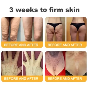 FDA Approved-๐
๐ฅ๐ฒ๐ฌ๐ฆ๐ฎ๐ฌโข ๐๐๐ฏ๐๐ง๐๐๐ ๐๐จ๐ฅ๐ฅ๐๐ ๐๐ง ๐๐๐ฉ๐ญ๐ข๐๐ ๐
๐ข๐ซ๐ฆ๐ข๐ง๐ ๐๐ซ๐๐๐ฆ, ๐๐๐๐ซ๐๐ฌ๐ฌ ๐๐ซ๐๐ฉ๐ & ๐๐๐ ๐ ๐ข๐ง๐