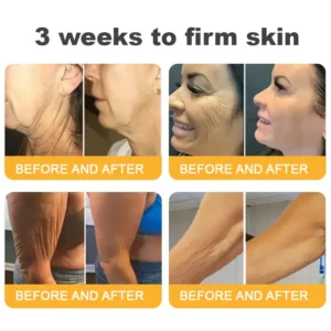 FDA Approved-๐
๐ฅ๐ฒ๐ฌ๐ฆ๐ฎ๐ฌโข ๐๐๐ฏ๐๐ง๐๐๐ ๐๐จ๐ฅ๐ฅ๐๐ ๐๐ง ๐๐๐ฉ๐ญ๐ข๐๐ ๐
๐ข๐ซ๐ฆ๐ข๐ง๐ ๐๐ซ๐๐๐ฆ, ๐๐๐๐ซ๐๐ฌ๐ฌ ๐๐ซ๐๐ฉ๐ & ๐๐๐ ๐ ๐ข๐ง๐
