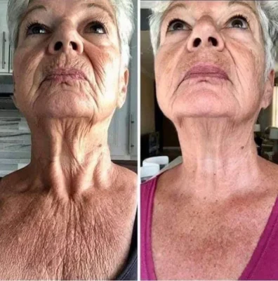 Fylsmus™ Collagen Peptides Wrinkle Removal Cream