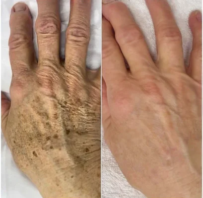HUDROS™ RETINOL ANTI-AGING SKIN RENEWING CREAM