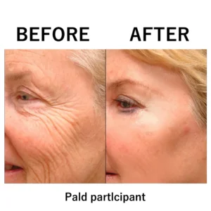 Instant Temporary Face Tightener