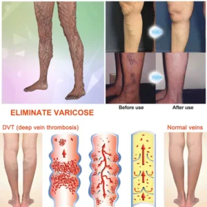 Alternative view of KINGURR® Negative Ion Detox Body Shaping Socks for Body Sculpting