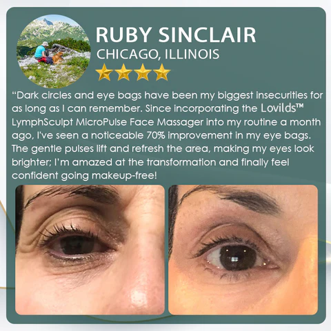LOVILDS™LymphSculpt MicroPulse Face Massager