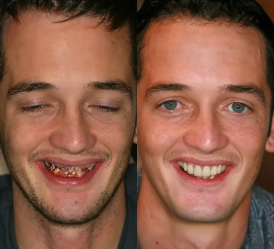 Lovilds® Teeth Restoration Mineral Powder
