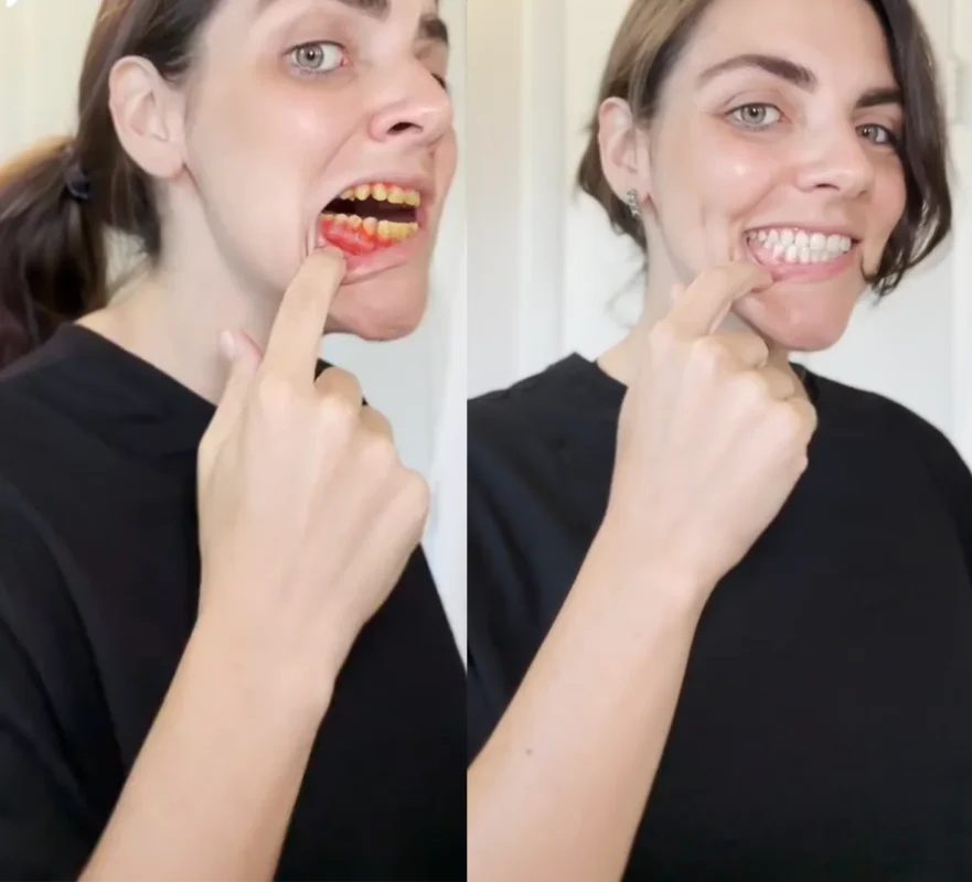 Lovilds® Teeth Restoration Mineral Powder