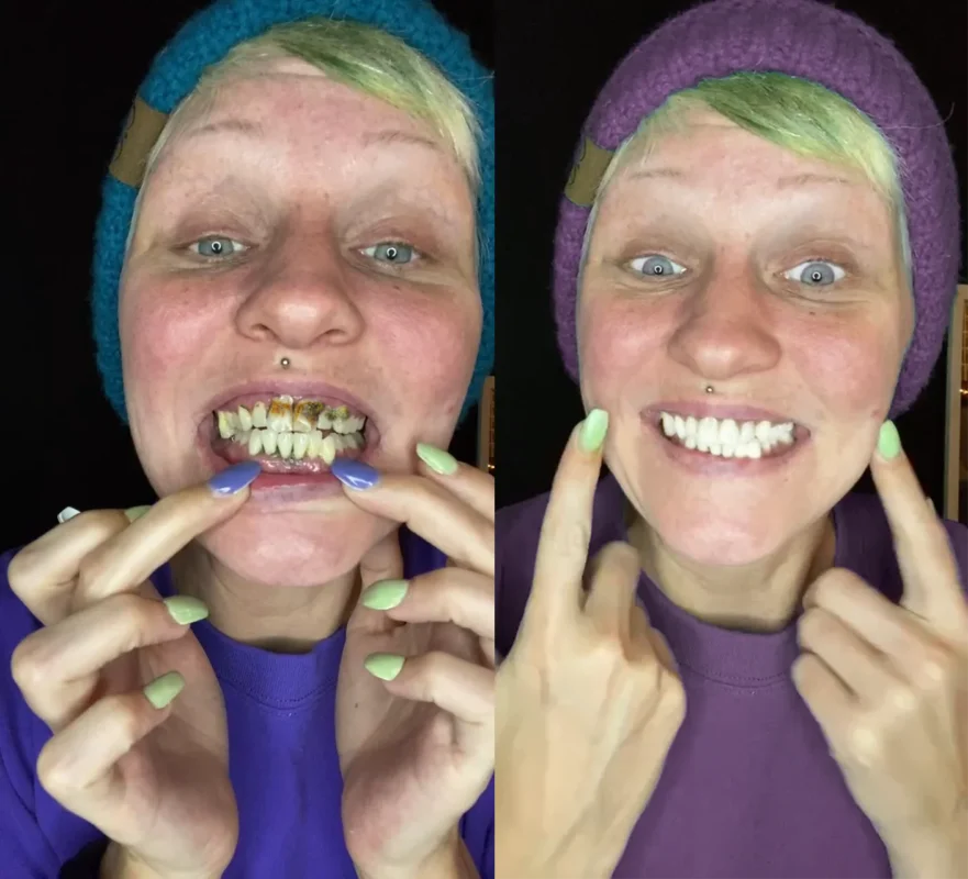 Lovilds® Teeth Restoration Mineral Powder