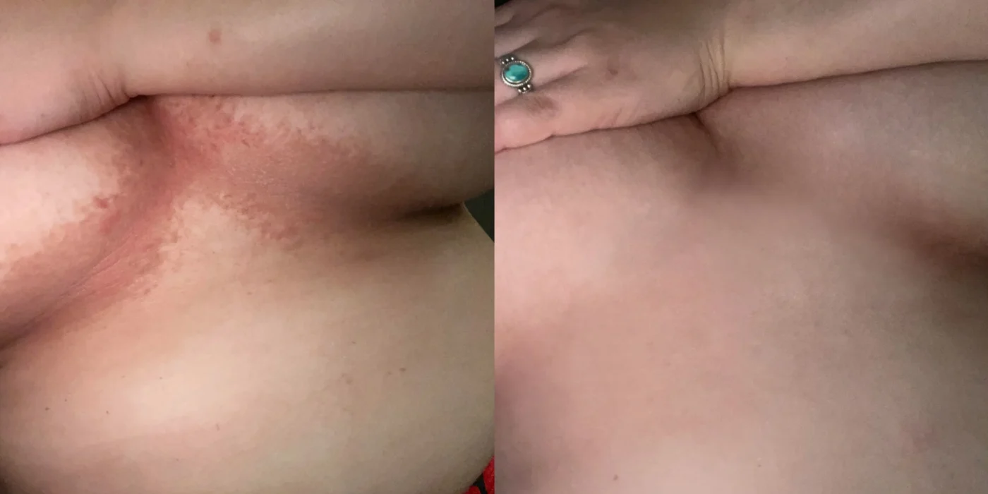 PISPARA™ Jelly Gel Shaping Bra