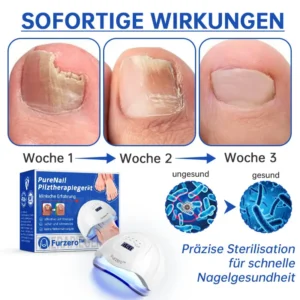 PureNail™ Die effektive Lösung gegen Nagelpilz – Für gesunde, schöne Nägel