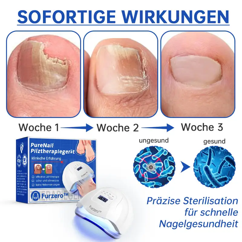 PureNail™ Die effektive Lösung gegen Nagelpilz – Für gesunde, schöne Nägel