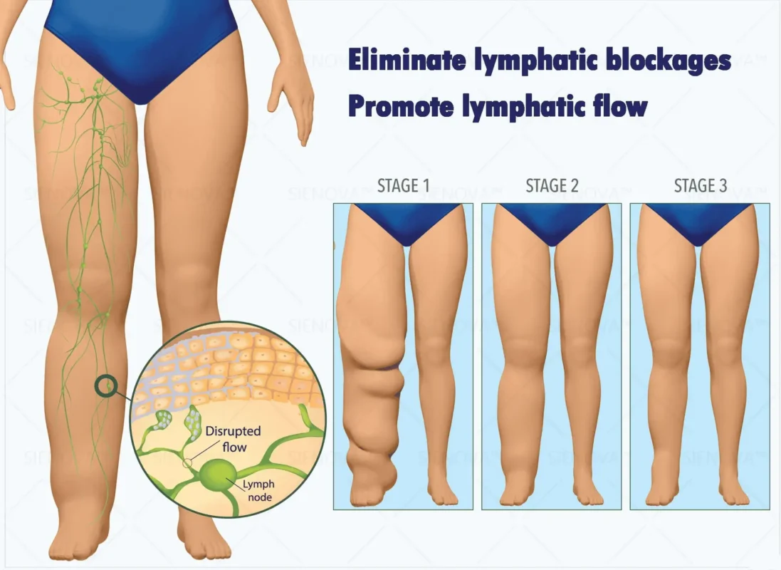 SIE𝖭𝖮𝖵𝖠™✨ Portable Lymphatic Detox And Joint Relaxation Therapy Device
