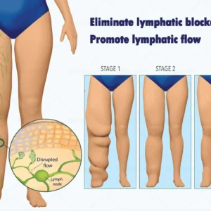 SIE𝖭𝖮𝖵𝖠™✨ Portable Lymphatic Detox And Joint Relaxation Therapy Device