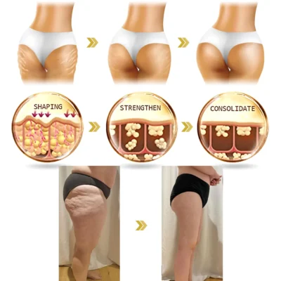 FDA Approved-๐
๐ฅ๐ฒ๐ฌ๐ฆ๐ฎ๐ฌโข ๐๐๐ฏ๐๐ง๐๐๐ ๐๐จ๐ฅ๐ฅ๐๐ ๐๐ง ๐๐๐ฉ๐ญ๐ข๐๐ ๐
๐ข๐ซ๐ฆ๐ข๐ง๐ ๐๐ซ๐๐๐ฆ, ๐๐๐๐ซ๐๐ฌ๐ฌ ๐๐ซ๐๐ฉ๐ & ๐๐๐ ๐ ๐ข๐ง๐