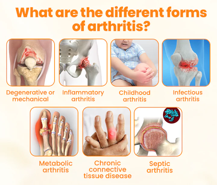 Biancat™ Bee Venom MobilitySupport Cream