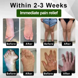 ArthroCareX™ Emu Oil JointRelief Ointment