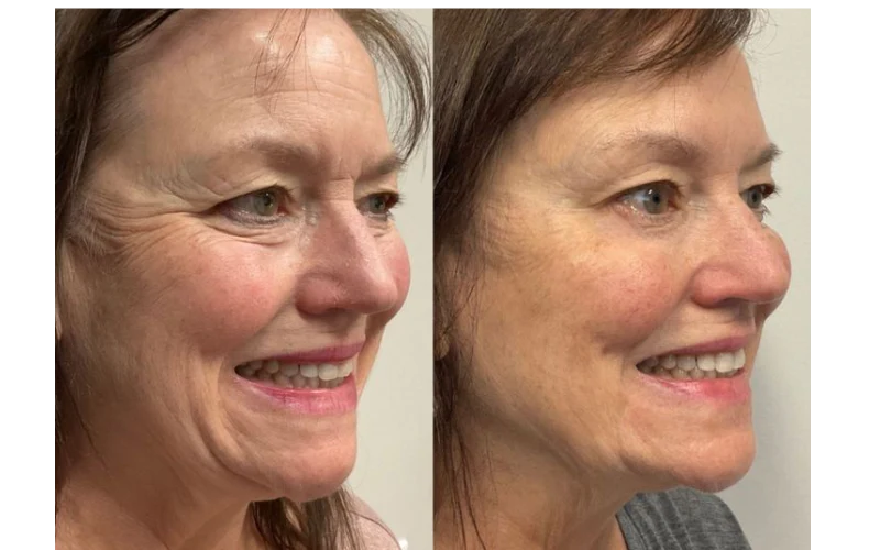 Biancat™ GlowDeluxe Collagen Skin Firming Cream