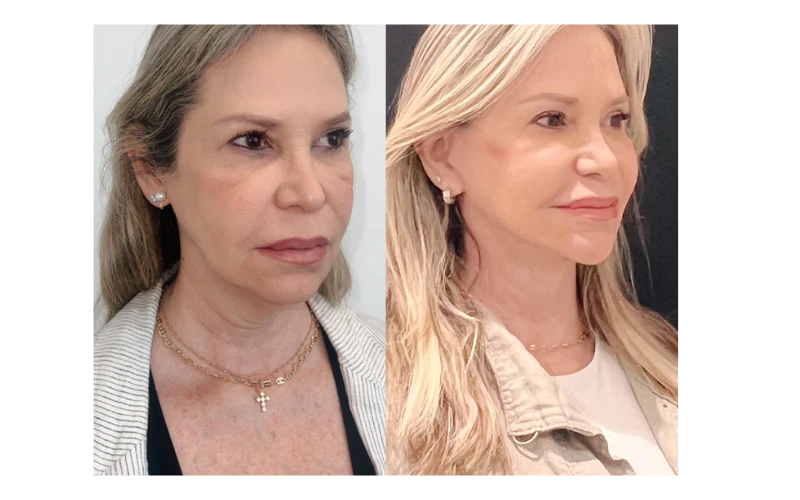 Biancat™ GlowDeluxe Collagen Skin Firming Cream