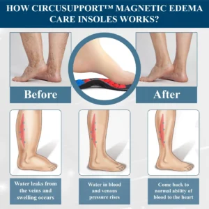 CircuSupport™ Magnetic EdemaCare Insoles