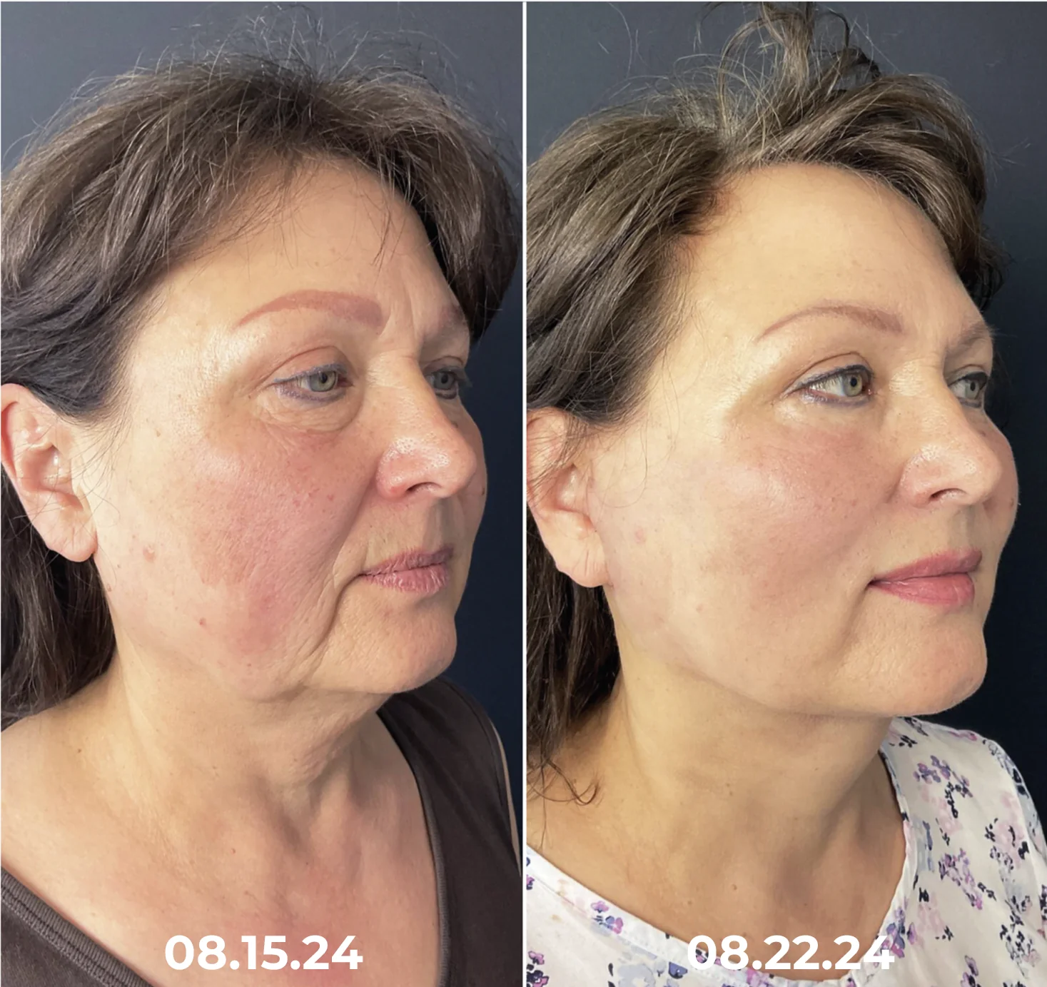 Dobshow™ Collagen+ Bee Venom Daily Wake Up Eye Cream
