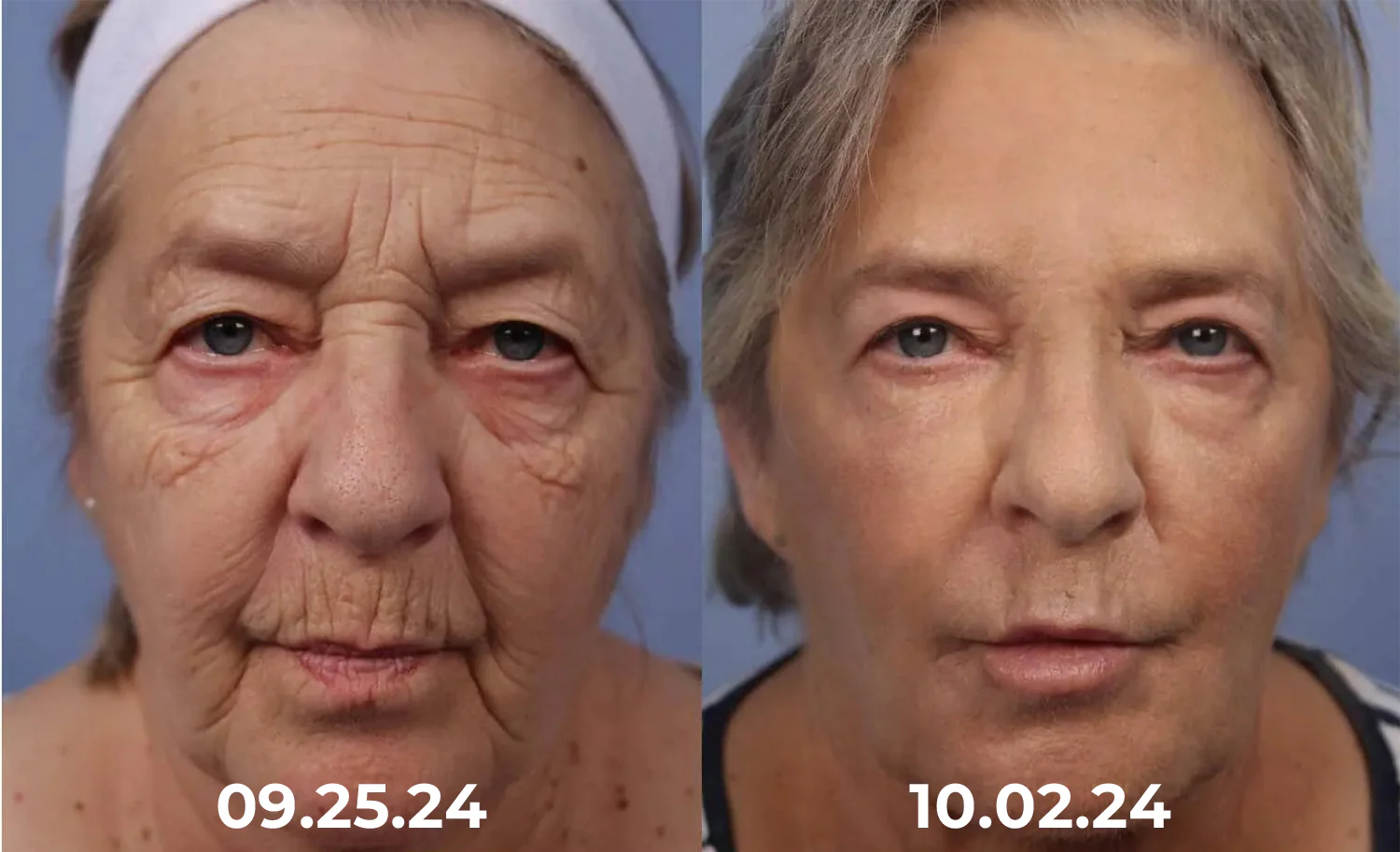 Dobshow™ Collagen+ Bee Venom Daily Wake Up Eye Cream