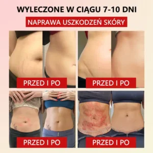 Flouris™ Mikro-wibracyjny Pas Wzmacniający Zioło Piołun do Kształtowania Ciała