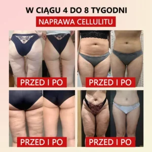 Flouris™ Mikro-wibracyjny Pas Wzmacniający Zioło Piołun do Kształtowania Ciała