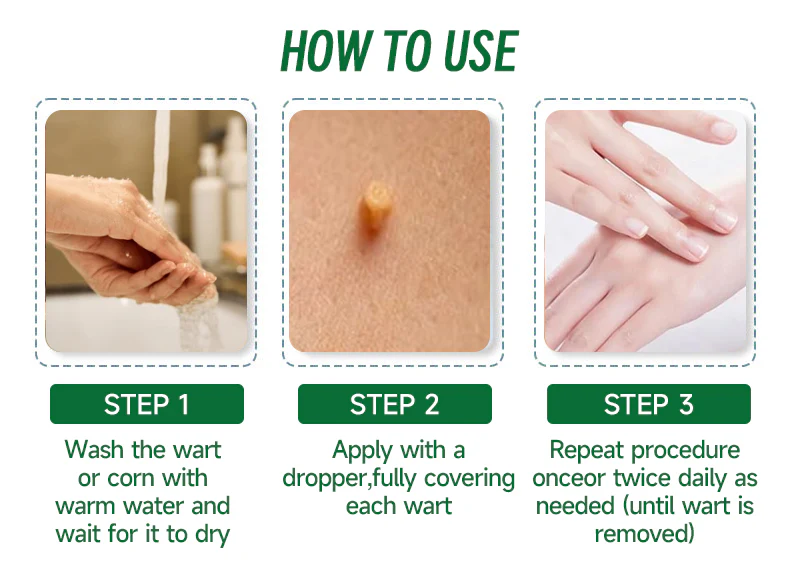Furzero™ 20% Salicylic Acid Skin Treatment Cream