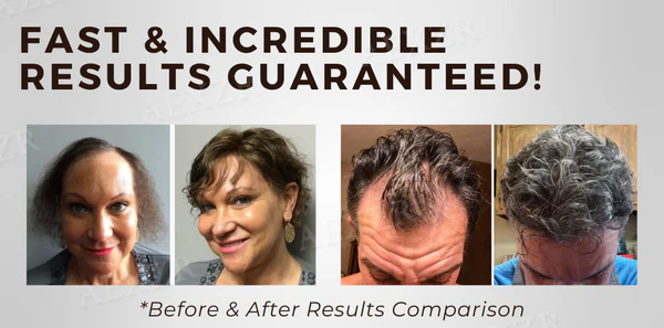 Hairgenz™ Hair Regrowth Capsules