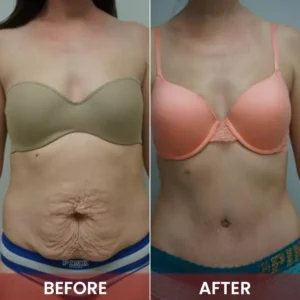 LIMETOW™ Magic Luxury Body Oil