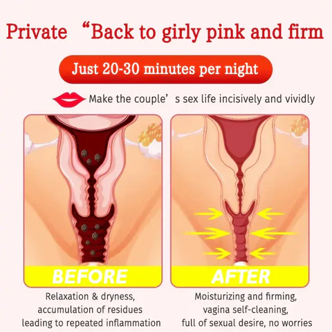 Lenreey®Bee Venom NMN Natural Repair Vaginal Capsules