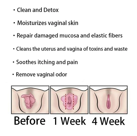 Lenreey®Bee Venom NMN Natural Repair Vaginal Capsules