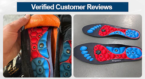 Magnetic EdemaCare Insoles