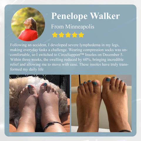 Magnetic EdemaCare Insoles
