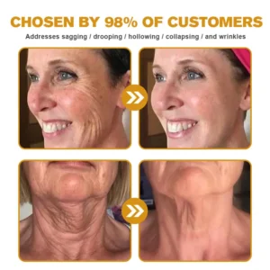 🎉NEW YEAR SALE🎉- 𝕤𝕒𝕧𝕖 𝕦𝕡 𝕥𝕠 -𝟟𝟘% 🅾🅵🅵 Furzero™ Botox Bee Venom Wrinkle Removal Cream