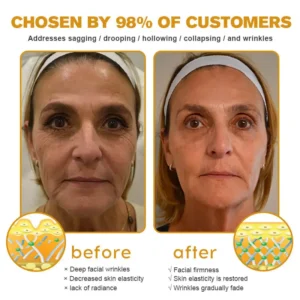 🎉NEW YEAR SALE🎉- 𝕤𝕒𝕧𝕖 𝕦𝕡 𝕥𝕠 -𝟟𝟘% 🅾🅵🅵 Furzero™ Botox Bee Venom Wrinkle Removal Cream
