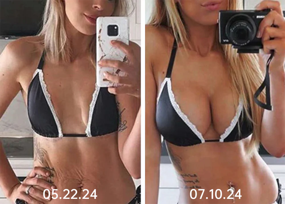 Nurbini™ ElectraLift EMS Bust Massager Bra