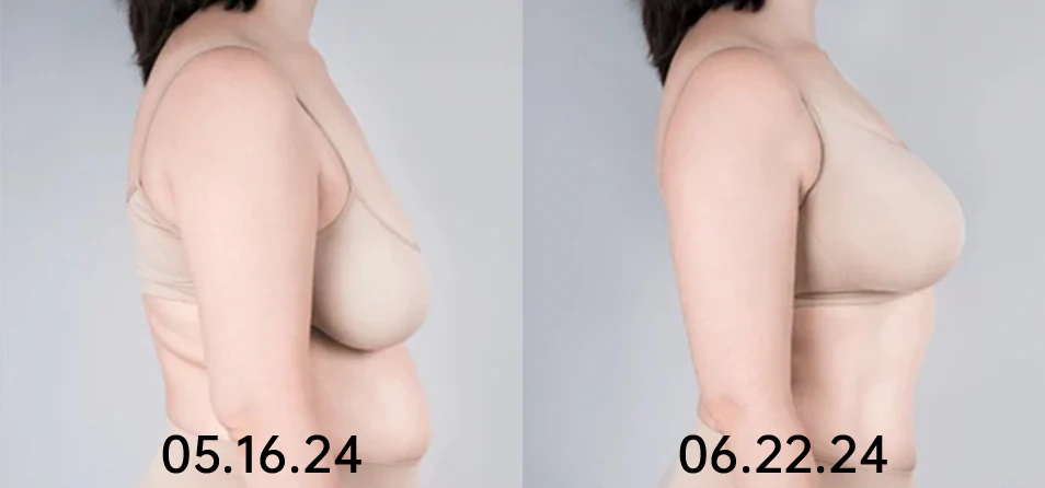Nurbini™ ElectraLift EMS Bust Massager Bra