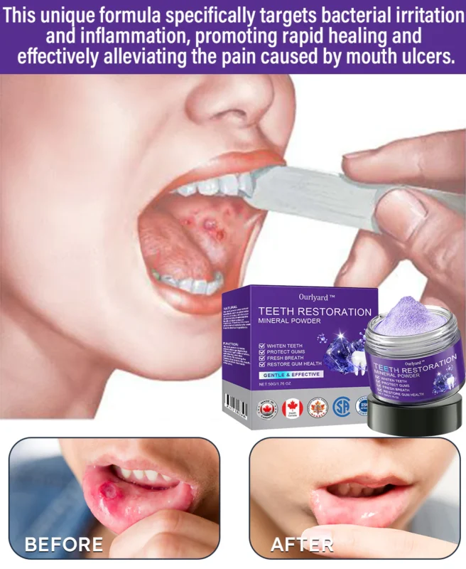 Ourlyard™ Teeth Restoration Mineral Powder