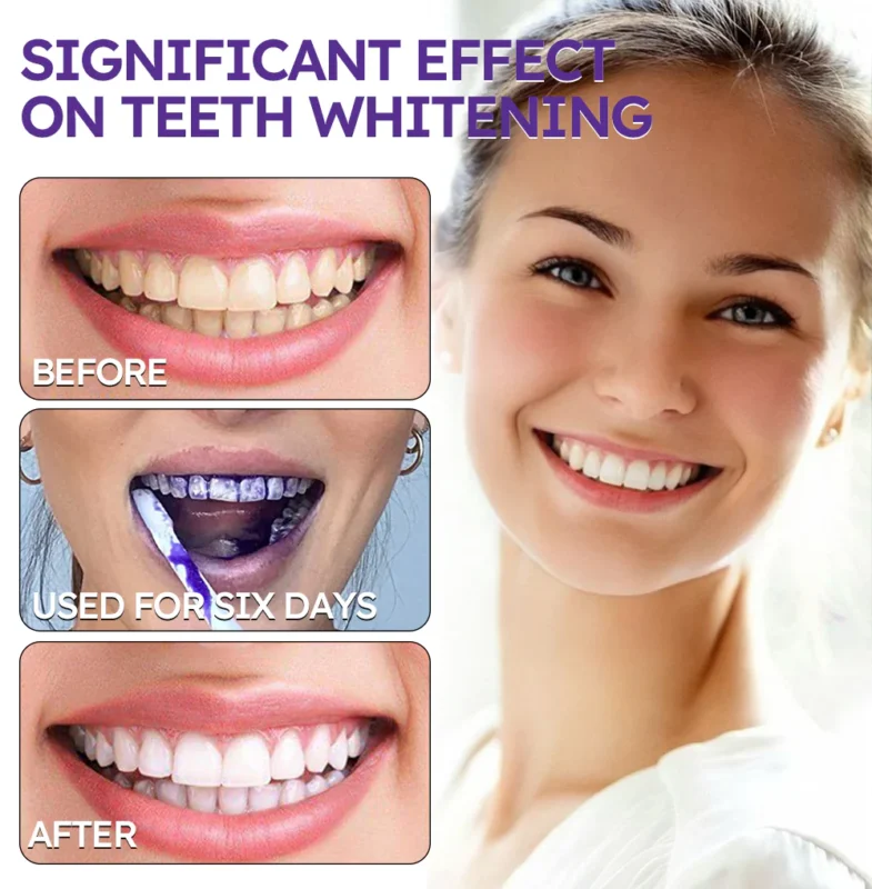 Ourlyard™ Teeth Restoration Mineral Powder