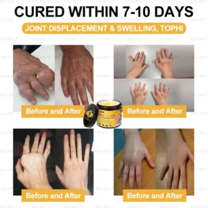 Raindew™ Bee Venom Pain Relief Bone Healing Cream