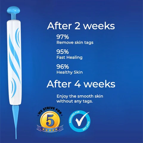 Seurico™ At-home Skin Tag Removal Pen