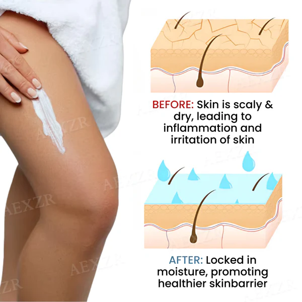 Skinetiv™ Skin Chaps Cream