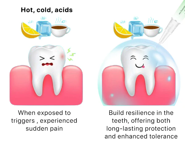 Wuize™ Sensitive Teeth Repairing Gel