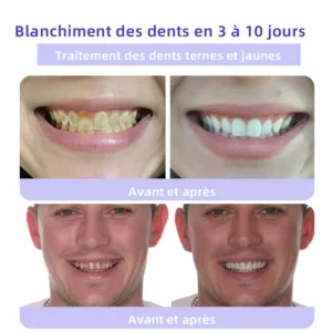 𝐎𝐲𝐢𝐤𝐞𝐲™ 𝐓𝐞𝐞𝐭𝐡 𝐑𝐞𝐬𝐭𝐨𝐫𝐚𝐭𝐢𝐨𝐧 𝐏𝐨𝐮𝐝𝐫𝐞 𝐌𝐢𝐧é𝐫𝐚𝐥𝐞👨‍⚕️(𝐑𝐞𝐜𝐨𝐦𝐦𝐚𝐧𝐝é 𝐩𝐚𝐫 𝐀𝐬𝐬𝐨𝐜𝐢𝐚𝐭𝐢𝐨𝐧 𝐃𝐞𝐧𝐭𝐚𝐢𝐫𝐞 𝐅𝐫𝐚𝐧ç𝐚𝐢𝐬𝐞)💎💎💎 𝐎𝐲𝐢𝐤𝐞𝐲™ 𝐓𝐞𝐞𝐭𝐡 𝐑𝐞𝐬𝐭𝐨𝐫𝐚𝐭𝐢𝐨𝐧 𝐏𝐨𝐮𝐝𝐫𝐞 𝐌𝐢𝐧é𝐫𝐚𝐥𝐞