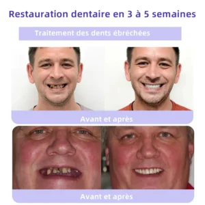 𝐎𝐲𝐢𝐤𝐞𝐲™ 𝐓𝐞𝐞𝐭𝐡 𝐑𝐞𝐬𝐭𝐨𝐫𝐚𝐭𝐢𝐨𝐧 𝐏𝐨𝐮𝐝𝐫𝐞 𝐌𝐢𝐧é𝐫𝐚𝐥𝐞👨‍⚕️(𝐑𝐞𝐜𝐨𝐦𝐦𝐚𝐧𝐝é 𝐩𝐚𝐫 𝐀𝐬𝐬𝐨𝐜𝐢𝐚𝐭𝐢𝐨𝐧 𝐃𝐞𝐧𝐭𝐚𝐢𝐫𝐞 𝐅𝐫𝐚𝐧ç𝐚𝐢𝐬𝐞)💎💎💎 𝐎𝐲𝐢𝐤𝐞𝐲™ 𝐓𝐞𝐞𝐭𝐡 𝐑𝐞𝐬𝐭𝐨𝐫𝐚𝐭𝐢𝐨𝐧 𝐏𝐨𝐮𝐝𝐫𝐞 𝐌𝐢𝐧é𝐫𝐚𝐥𝐞